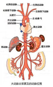 大动脉炎最常累及